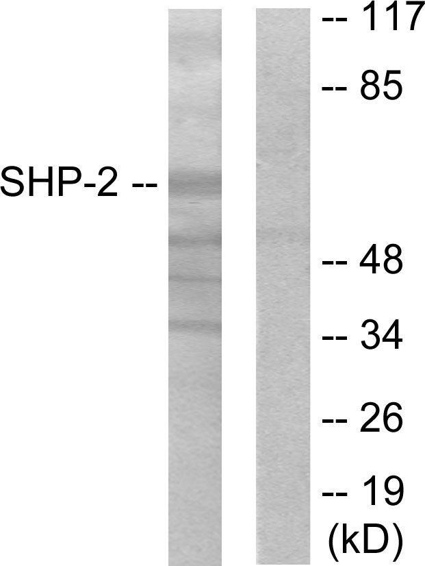 PTPN11 / SHP-2 / NS1 Antibody - Western blot analysis of lysates from A431 cells, using SHP-2 Antibody. The lane on the right is blocked with the synthesized peptide.