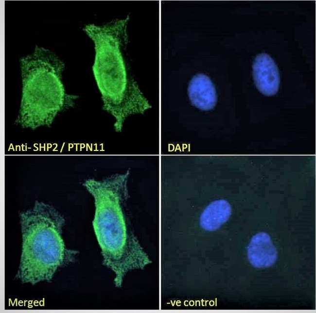 PTPN11 / SHP-2 / NS1 Antibody - SHP2 / PTPN11 Antibody Immunofluorescence analysis of paraformaldehyde fixed HeLa cells, permeabilized with 0.15% Triton. Primary incubation 1hr (10ug/ml) followed by Alexa Fluor 488 secondary antibody (2ug/ml), showing nuclear and cytoplasmic staining. The nuclear stain is DAPI (blue). Negative control: Unimmunized goat IgG (10ug/ml) followed by Alexa Fluor 488 secondary antibody (2ug/ml).