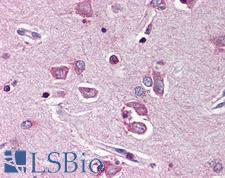 PTPN11 / SHP-2 / NS1 Antibody - Anti-PTPN11 antibody IHC of human brain, cortex. Immunohistochemistry of formalin-fixed, paraffin-embedded tissue after heat-induced antigen retrieval. Antibody concentration 5 ug/ml.