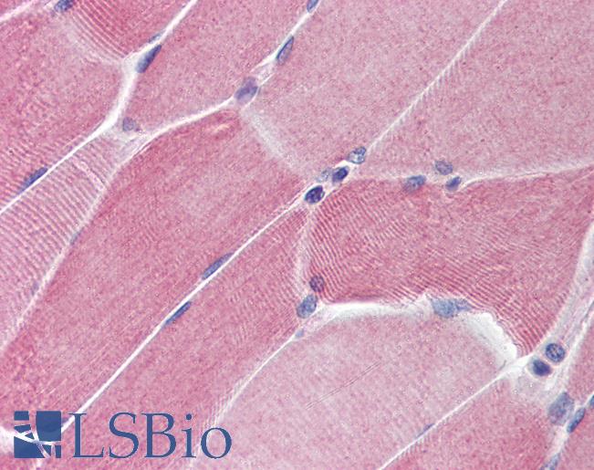 PTPN11 / SHP-2 / NS1 Antibody - Anti-PTPN11 antibody IHC of human skeletal muscle. Immunohistochemistry of formalin-fixed, paraffin-embedded tissue after heat-induced antigen retrieval. Antibody concentration 5 ug/ml.