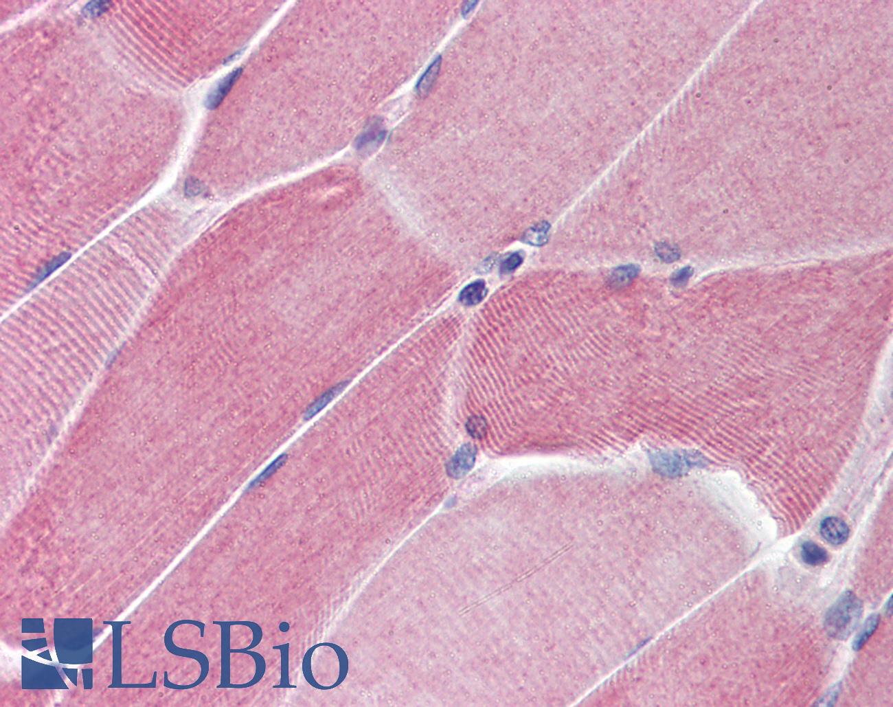 PTPN11 / SHP-2 / NS1 Antibody - Anti-PTPN11 antibody IHC of human skeletal muscle. Immunohistochemistry of formalin-fixed, paraffin-embedded tissue after heat-induced antigen retrieval. Antibody concentration 5 ug/ml.