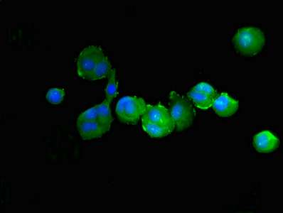 PTPN6 / SHP1 Antibody - Immunofluorescent analysis of MCF-7 cells using PTPN6 Antibody at dilution of 1:100 and Alexa Fluor 488-congugated AffiniPure Goat Anti-Rabbit IgG(H+L)