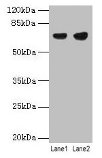 PTPN6 / SHP1 Antibody - Western blot All lanes: PTPN6 antibody at 12µg/ml Lane 1: Jurkat whole cell lysate Lane 2: Raji whole cell lysate Secondary Goat polyclonal to rabbit IgG at 1/10000 dilution Predicted band size: 68, 64, 71 kDa Observed band size: 68 kDa