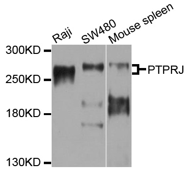 PTPRJ / CD148 Antibody - Western blot analysis of extracts of various cell lines, using PTPRJ antibody at 1:1000 dilution. The secondary antibody used was an HRP Goat Anti-Rabbit IgG (H+L) at 1:10000 dilution. Lysates were loaded 25ug per lane and 3% nonfat dry milk in TBST was used for blocking. An ECL Kit was used for detection and the exposure time was 60s.