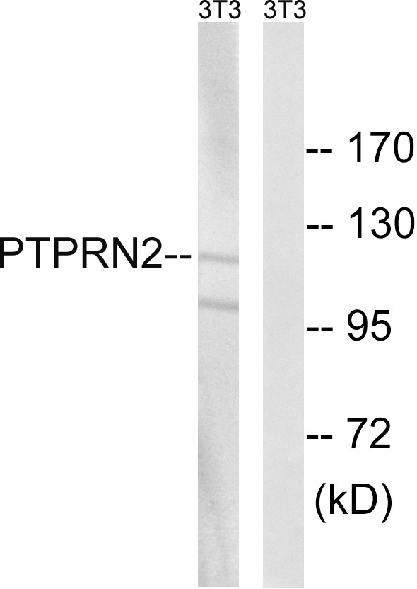 PTPRN2 / Phogrin Antibody - Western blot analysis of lysates from NIH/3T3 cells, using PTPRN2 Antibody. The lane on the right is blocked with the synthesized peptide.