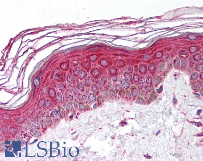 PTPRR Antibody - Anti-PTPRR antibody IHC of human skin. Immunohistochemistry of formalin-fixed, paraffin-embedded tissue after heat-induced antigen retrieval. Antibody concentration 10 ug/ml.