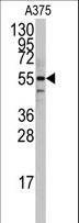 PTRF / CAVIN Antibody - Western blot of anti-PTRF Antibody in A375 cell line lysates (35 ug/lane). PTRF(arrow) was detected using the purified antibody.