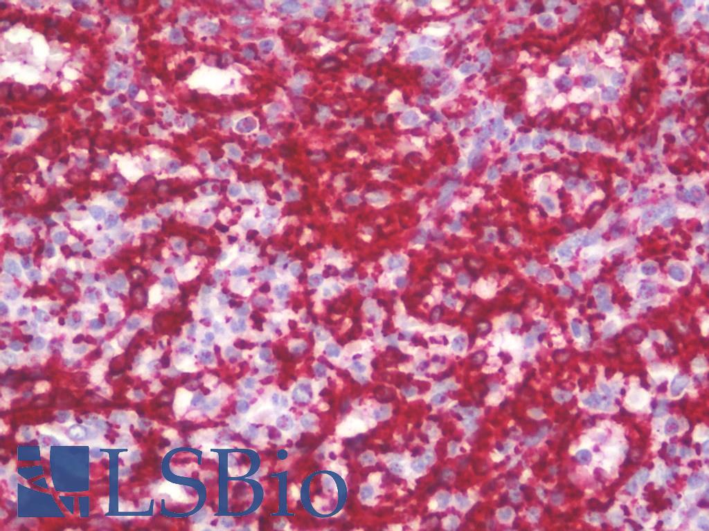 PTRF / CAVIN Antibody - Anti-PTRF / CAVIN antibody IHC staining of human spleen. Immunohistochemistry of formalin-fixed, paraffin-embedded tissue after heat-induced antigen retrieval. Antibody concentration 10 ug/ml.