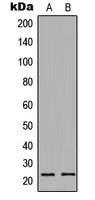 PTTG1IP / PBF Antibody - Western blot analysis of PTTG1IP expression in human colon (A); Raw264.7 (B) whole cell lysates.