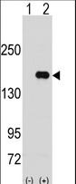 PUM2 Antibody - Western blot of PUM2 (arrow) using rabbit polyclonal PUM2 Antibody. 293 cell lysates (2 ug/lane) either nontransfected (Lane 1) or transiently transfected with the PUM2 gene (Lane 2) (Origene Technologies).