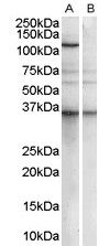 PUM2 Antibody - Antibody (1 ug/ml) staining of Human Epstein-Barr virus immortalized lymphoblastoid lysate (35 ug protein in RIPA buffer) with (B) and without (A) blocking with the immunizing peptide. Primary incubation was 1 hour. Detected by chemiluminescence.