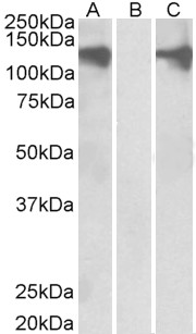 PUM2 Antibody - HEK293 lysate (10ug protein in RIPA buffer) overexpressing Human PUM2 with DYKDDDDK tag probed with PUM2 antibody (0.5ug/ml) in Lane A and probed with anti- DYKDDDDK Tag (1/3000) in lane C. Mock-transfected HEK293 probed with PUM2 antibody (1mg/ml) in Lane B. Primary incubations were for 1 hour. Detected by chemiluminescence.