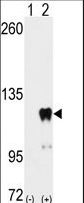 PUM2 Antibody - Western blot of PUM2 (arrow) using PUM2 Antibody (S182). 293 cell lysates (2 ug/lane) either nontransfected (Lane 1) or transiently transfected with the PUM2 gene (Lane 2) (Origene Technologies).
