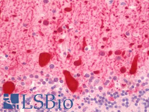 PVALB / Parvalbumin Antibody - Anti-PVALB / Parvalbumin antibody IHC staining of human brain, cerebellum. Immunohistochemistry of formalin-fixed, paraffin-embedded tissue after heat-induced antigen retrieval. Antibody dilution 1:50.