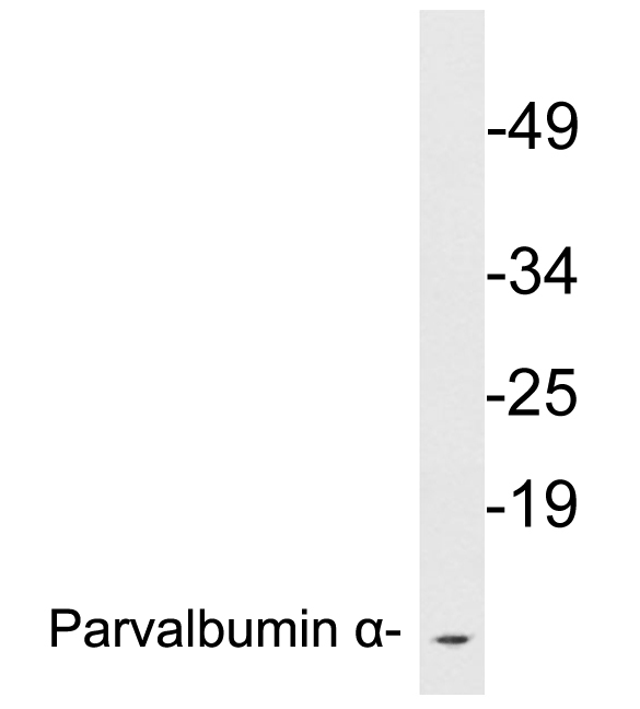 PVALB / Parvalbumin Antibody - Western blot analysis of lysates from ZR-75-1 cells, using Parvalbumin Î± antibody.