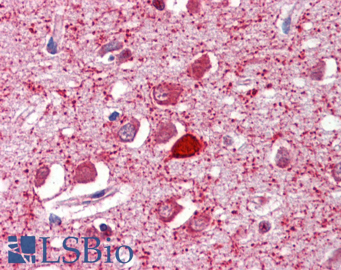 PVALB / Parvalbumin Antibody - Anti-PVALB / Parvalbumin antibody IHC of human brain, cortex. Immunohistochemistry of formalin-fixed, paraffin-embedded tissue after heat-induced antigen retrieval. Antibody concentration 2.5 ug/ml.