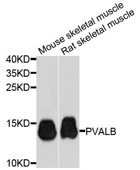 PVALB / Parvalbumin Antibody - Western blot analysis of extracts of various cell lines, using PVALB antibody at 1:1000 dilution. The secondary antibody used was an HRP Goat Anti-Rabbit IgG (H+L) at 1:10000 dilution. Lysates were loaded 25ug per lane and 3% nonfat dry milk in TBST was used for blocking. An ECL Kit was used for detection and the exposure time was 30s.