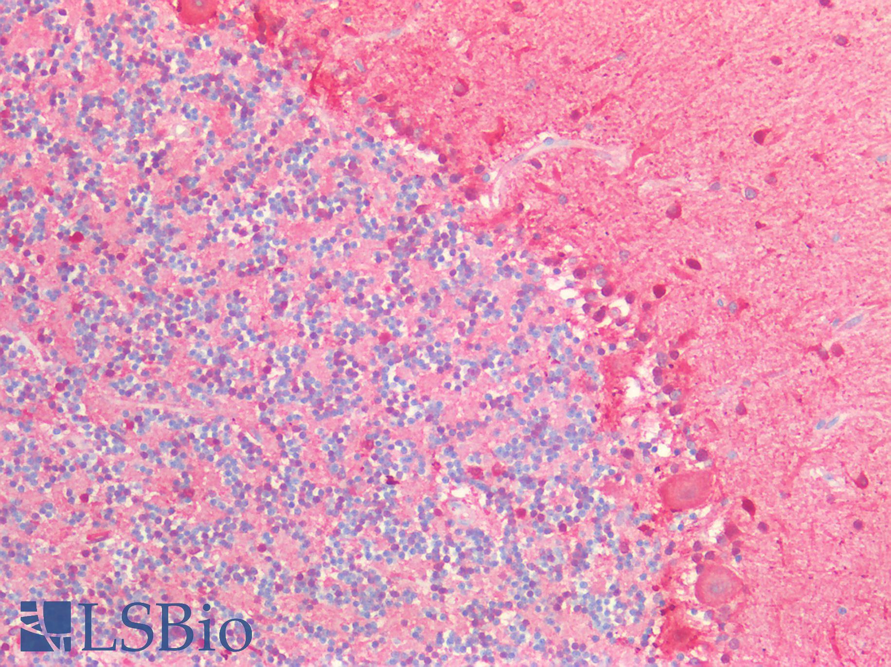 PVALB / Parvalbumin Antibody - Human Brain, Cerebellum: Formalin-Fixed, Paraffin-Embedded (FFPE)