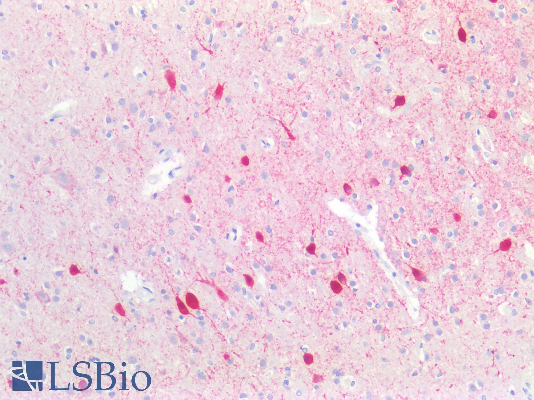 PVALB / Parvalbumin Antibody - Human Brain, Cortex: Formalin-Fixed, Paraffin-Embedded (FFPE)