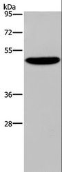 PVRL4 / Nectin 4 Antibody - Western blot analysis of SKOV3 cell, using PVRL4 Polyclonal Antibody at dilution of 1:350.