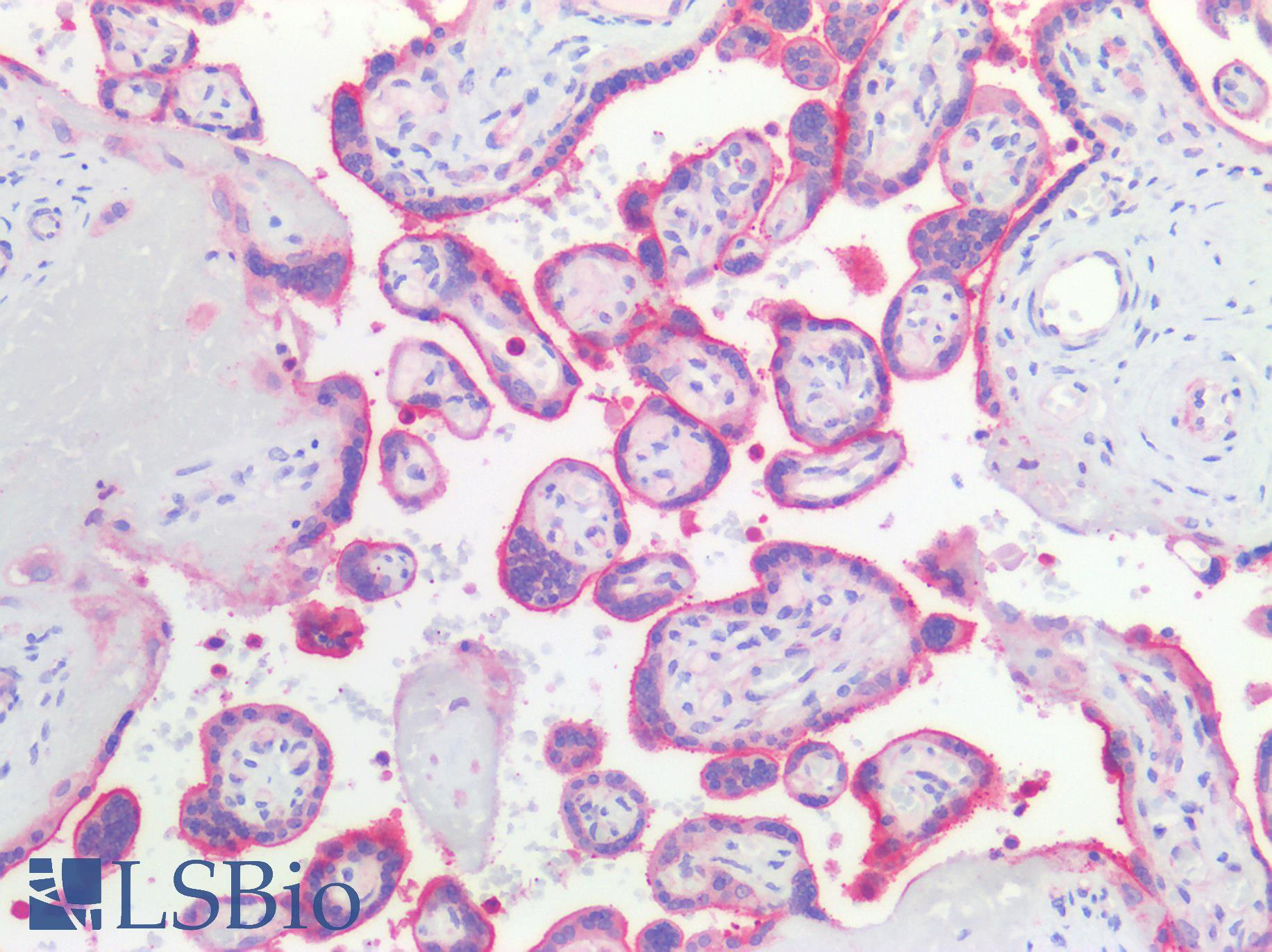 PVRL4 / Nectin 4 Antibody - Human Placenta: Formalin-Fixed, Paraffin-Embedded (FFPE)
