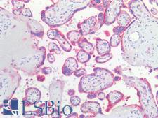 PVRL4 / Nectin 4 Antibody - Human Placenta: Formalin-Fixed, Paraffin-Embedded (FFPE)
