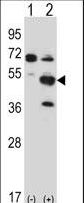 PXK Antibody - Western blot of Pxk (arrow) using rabbit polyclonal Mouse Pxk Antibody. 293 cell lysates (2 ug/lane) either nontransfected (Lane 1) or transiently transfected (Lane 2) with the Pxk gene.