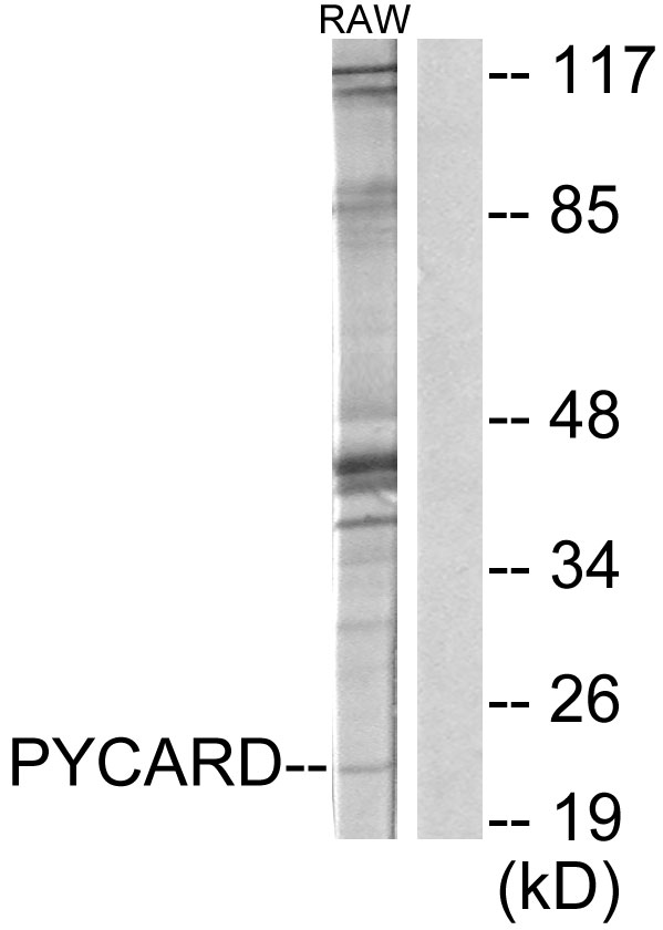PYCARD / ASC / TMS1 Antibody - Western blot analysis of lysates from RAW264.7 cells, using ASC Antibody. The lane on the right is blocked with the synthesized peptide.