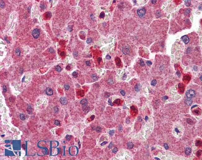 PYCARD / ASC / TMS1 Antibody - Anti-PYCARD antibody IHC of human liver. Immunohistochemistry of formalin-fixed, paraffin-embedded tissue after heat-induced antigen retrieval. Antibody concentration 2.5 ug/ml.