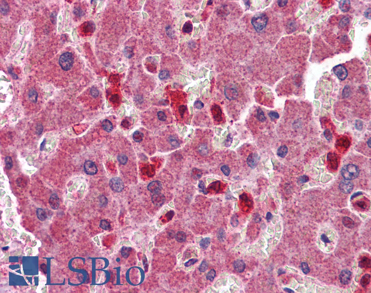 PYCARD / ASC / TMS1 Antibody - Anti-PYCARD antibody IHC of human liver. Immunohistochemistry of formalin-fixed, paraffin-embedded tissue after heat-induced antigen retrieval. Antibody concentration 2.5 ug/ml.