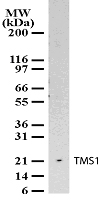 PYCARD / ASC / TMS1 Antibody - Western blot analysis for TMS1 using antibody at 2 ug/ml against 10 µg/lane of A549 cell lysate.