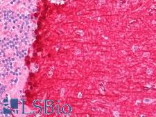 PYCARD / ASC / TMS1 Antibody - Human Brain, Cerebellum: Formalin-Fixed, Paraffin-Embedded (FFPE).  This image was taken for the unconjugated form of this product. Other forms have not been tested.