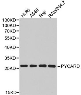 PYCARD / ASC / TMS1 Antibody - Western blot of PYCARD pAb in extracts from HL60, A549, Raji, Raw264.7 cells.