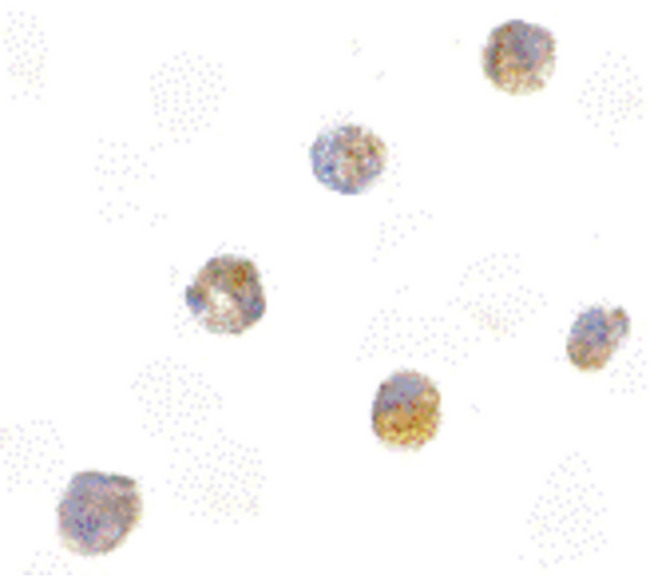 PYCARD / ASC / TMS1 Antibody - Immunocytochemistry of ASC in HL60 cells with ASC antibody at 5 ug/ml.