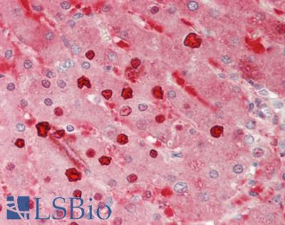PYGL Antibody - Human Liver: Formalin-Fixed, Paraffin-Embedded (FFPE).  This image was taken for the unconjugated form of this product. Other forms have not been tested.