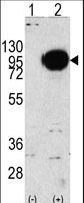 PYGM Antibody - Western blot of PYGM (arrow) using rabbit polyclonal PYGM Antibody. 293 cell lysates (2 ug/lane) either nontransfected (Lane 1) or transiently transfected with the PYGM gene (Lane 2) (Origene Technologies).