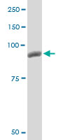 PYGM Antibody - PYGM monoclonal antibody, clone 2C4. Western blot of PYGM expression in PC-12.
