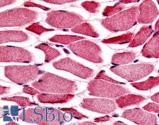PYGM Antibody - Anti-PYGM / Phosphorylase b antibody IHC of human skeletal muscle. Immunohistochemistry of formalin-fixed, paraffin-embedded tissue after heat-induced antigen retrieval.