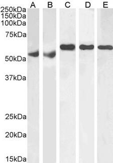 QIP1 / KPNA4 Antibody - QIP1 / KPNA4 antibody (1µg/ml) staining of Human Testes (A), Human Ovary (B), Mouse Testes (C), Rat Testes (D) and Rat Ovary (E) lysate (RIPA buffer, 35µg total protein per lane). Detected by chemiluminescence.