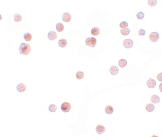 QIP1 / KPNA4 Antibody - Immunocytochemistry of KPNA4 in HeLa cells with KPNA4 antibody at 2.5 ug/ml.