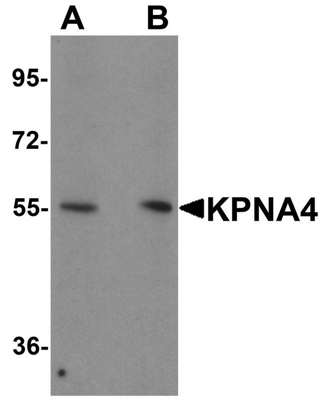 QIP1 / KPNA4 Antibody - Western blot analysis of KPNA1 in HeLa cell lysate with KPNA1 antibody at 1ug/ml.