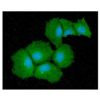 QPRT Antibody - ICC/IF analysis of QPRT in Hep3B cells line, stained with DAPI (Blue) for nucleus staining and monoclonal anti-human QPRT antibody (1:100) with goat anti-mouse IgG-Alexa fluor 488 conjugate (Green).
