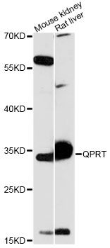 QPRT Antibody - Western blot analysis of extracts of various cell lines, using QPRT antibody at 1:3000 dilution. The secondary antibody used was an HRP Goat Anti-Rabbit IgG (H+L) at 1:10000 dilution. Lysates were loaded 25ug per lane and 3% nonfat dry milk in TBST was used for blocking. An ECL Kit was used for detection and the exposure time was 90s.