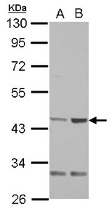 QTRT1 Antibody - Sample (30 ug of whole cell lysate) A: NT2D1 B: PC-3 10% SDS PAGE QTRT1 antibody diluted at 1:1000