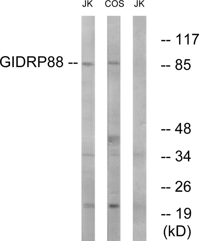 R3HCC1L / C10orf28 Antibody - Western blot analysis of lysates from Jurkat and COS cells, using GIDRP88 Antibody. The lane on the right is blocked with the synthesized peptide.