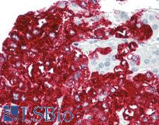 R3HCC1L / C10orf28 Antibody - Anti-C10orf28 antibody IHC of human adrenal. Immunohistochemistry of formalin-fixed, paraffin-embedded tissue after heat-induced antigen retrieval. Antibody dilution 5 ug/ml.