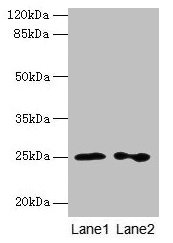 RAB11B Antibody - Western blot All lanes: RAB11B antibody at 2µg/ml Lane 1: Hela cells Lane 2: Rat gonad tissue Secondary Goat polyclonal to rabbit IgG at 1/10000 dilution Predicted band size: 25, 20 kDa Observed band size: 25 kDa