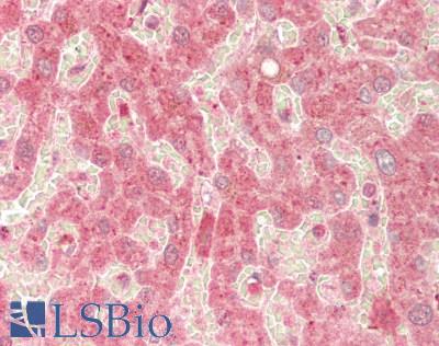 RAB14 Antibody - Human Liver: Formalin-Fixed, Paraffin-Embedded (FFPE)