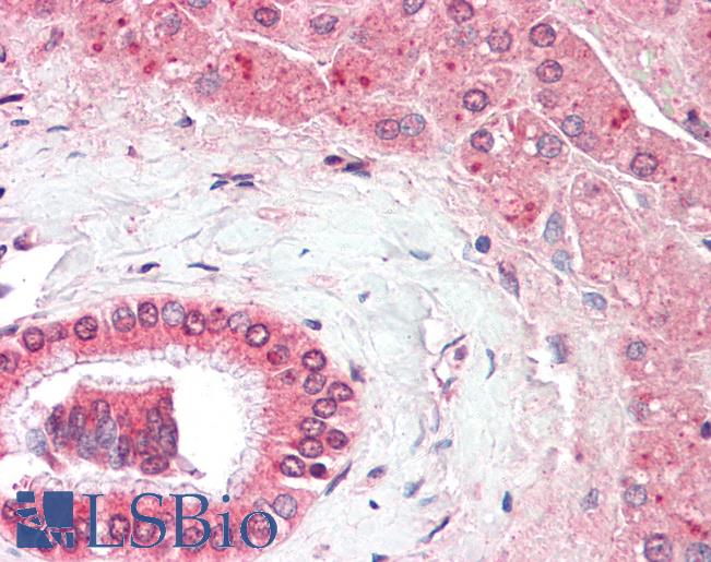 RAB18 Antibody - Human Liver: Formalin-Fixed, Paraffin-Embedded (FFPE)