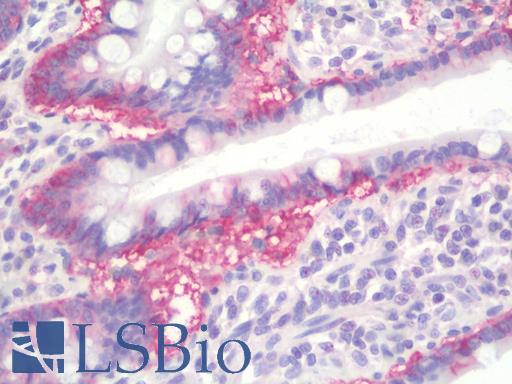 RAB1A Antibody - Anti-RAB1A / RAB1 antibody IHC staining of human small intestine. Immunohistochemistry of formalin-fixed, paraffin-embedded tissue after heat-induced antigen retrieval.